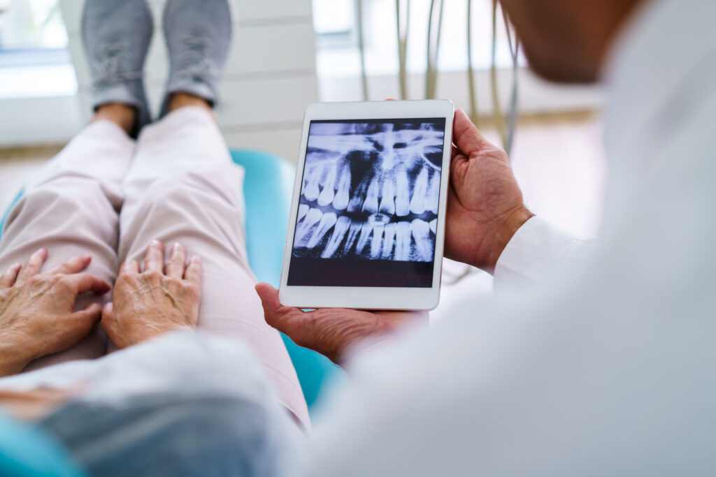 치료후관리 dental checkup shown with x ray on tablet