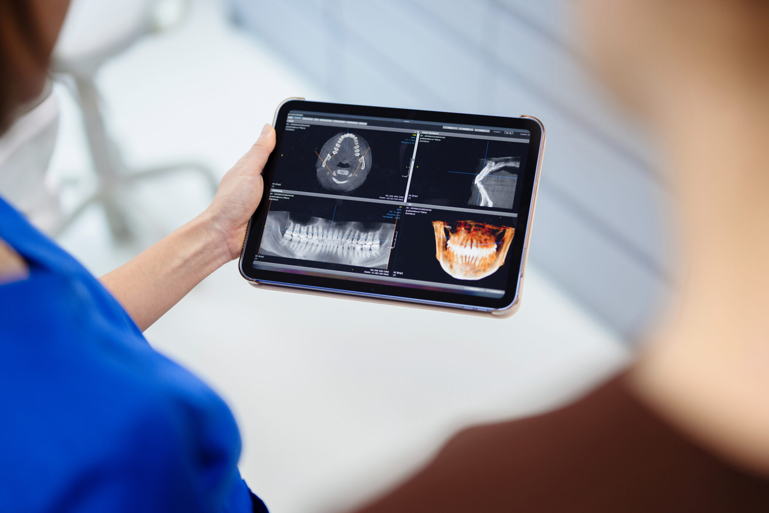 Home dentist reviewing dental x ray on tablet during consultation