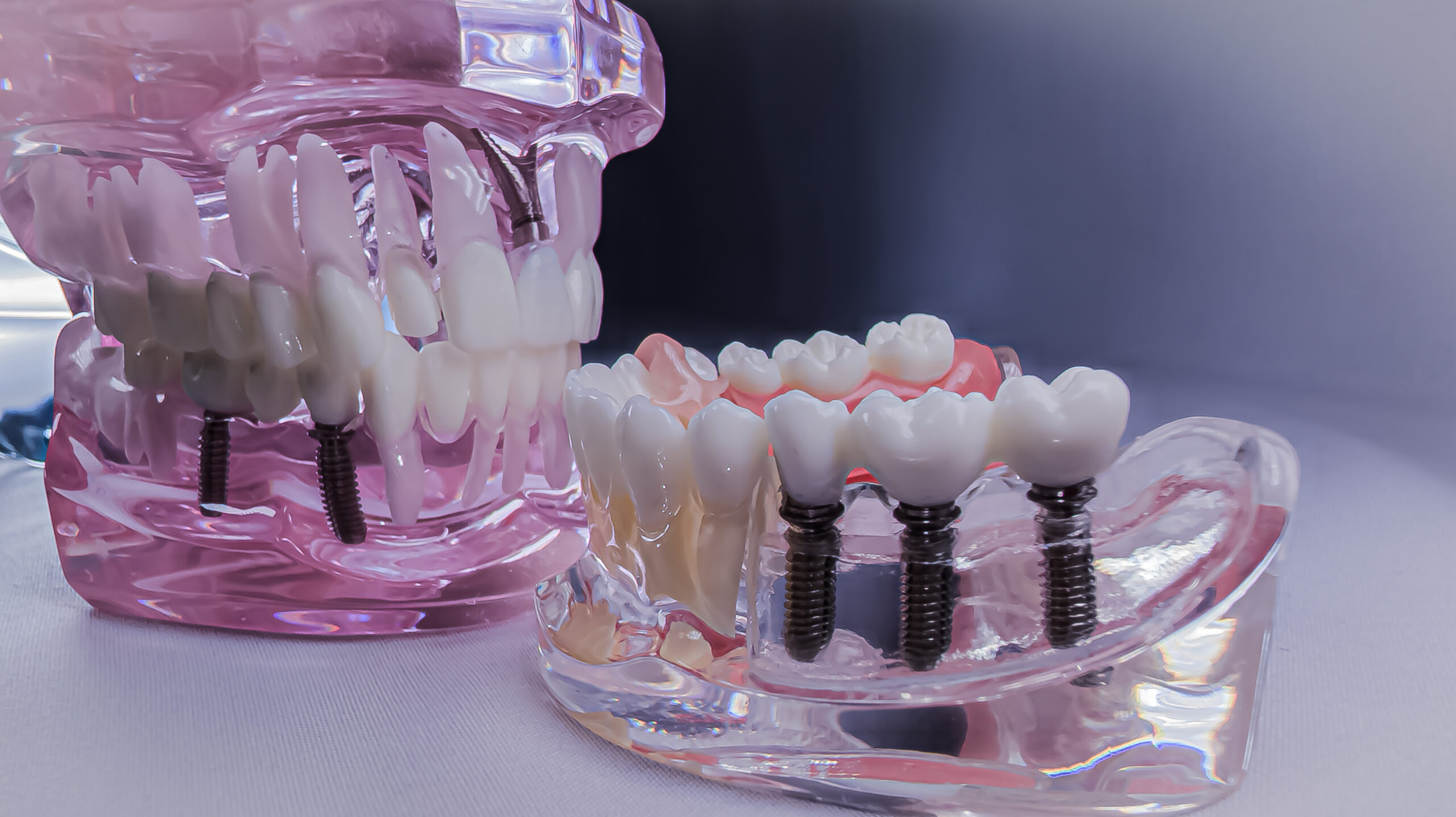 진료안내 close up of dental implants and models for educational purposes in a professional setting